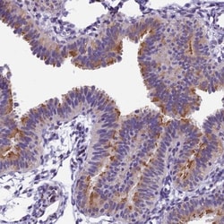 IFT140 Antibody, Novus Biologicals:Antibodies:Primary Antibodies